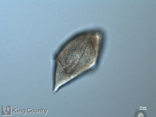 Photo of Gyrodinium spirale